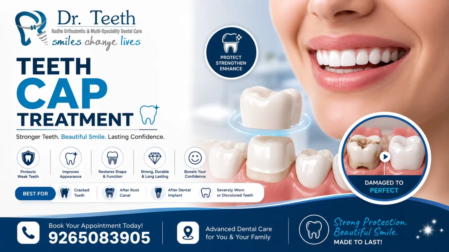Teeth Cap Treatment