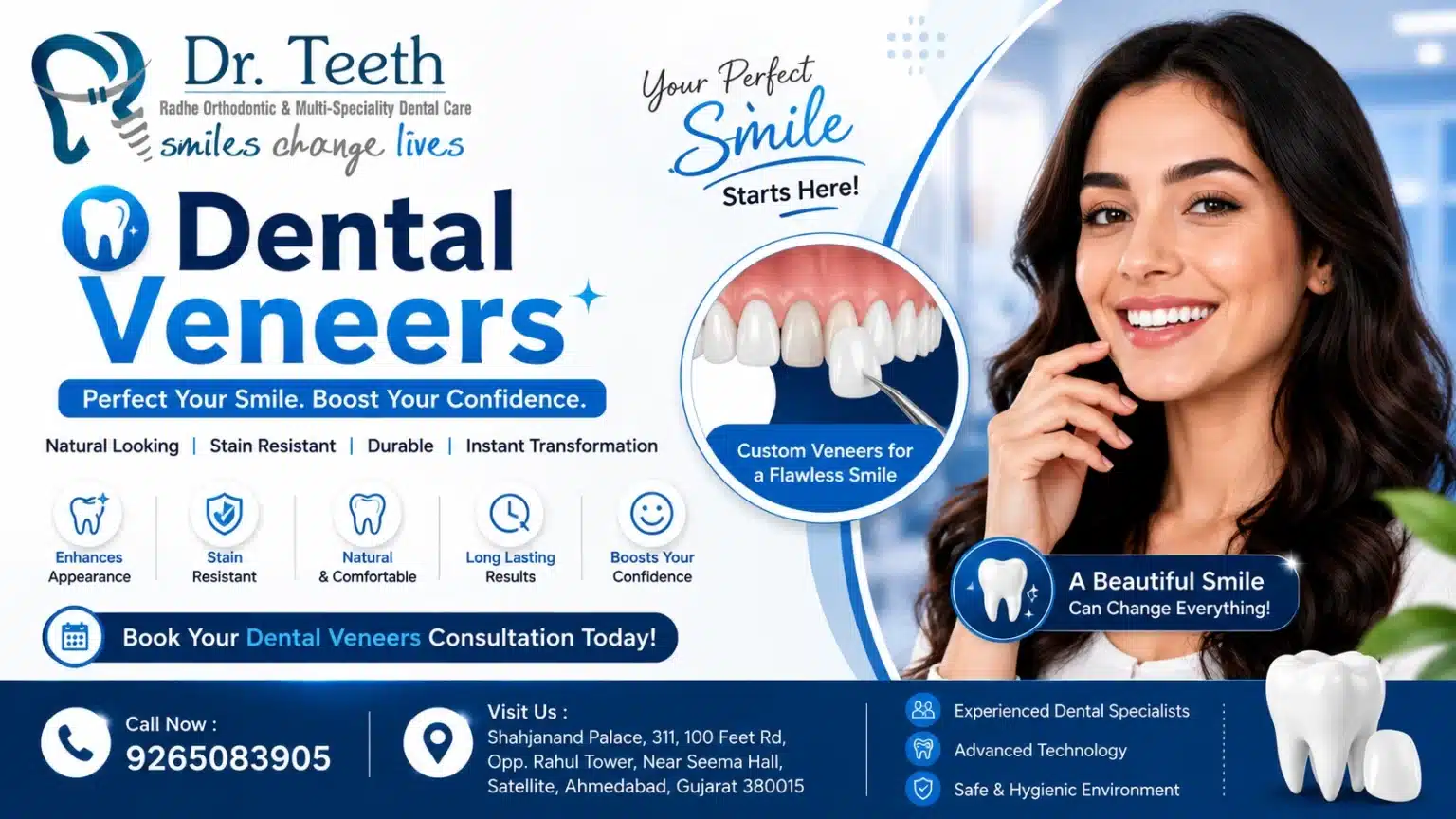 Dental Veneers