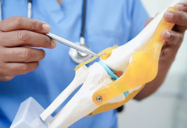 ACL INJURY TREATMENT