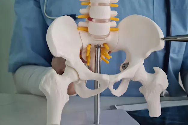 HIP REPLACEMENT SURGERY