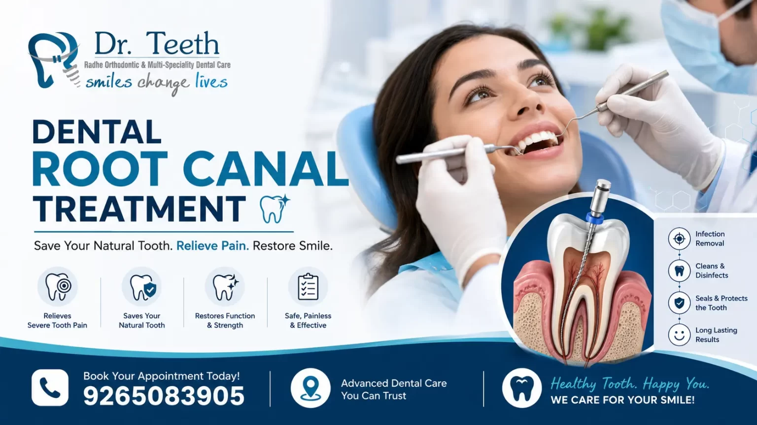 Dental Root Canal Treatment