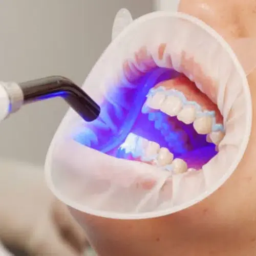 Digital Dentistry